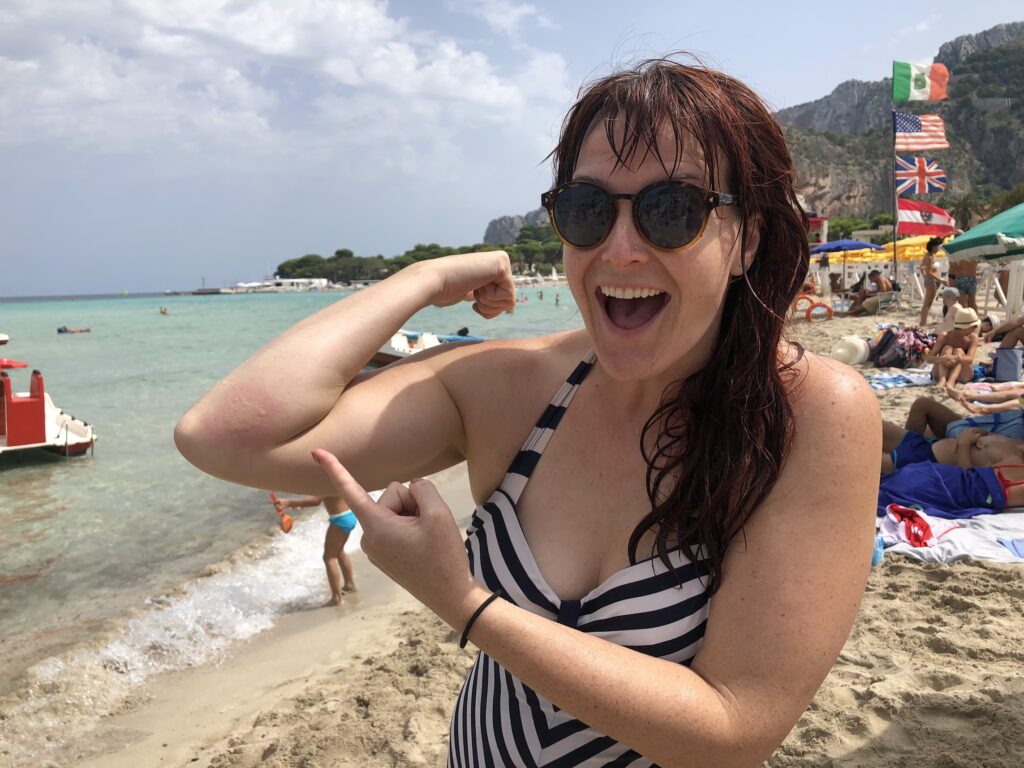 Carol in a black and white striped vintage bathing suit with the beach and mountains in the background. There are Italian flag, british flat and an american flag. Carol is holding up her right arm and pointing to a red welt where she got stung by a jellyfish.