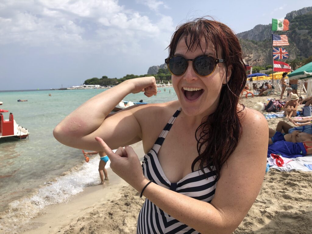 Carol in a black and white striped vintage bathing suit with the beach and mountains in the background. There are Italian flag, british flat and an american flag. Carol is holding up her right arm and pointing to a red welt where she got stung by a jellyfish. 